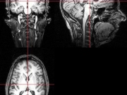 mri
