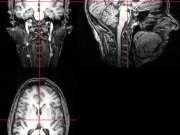 mri